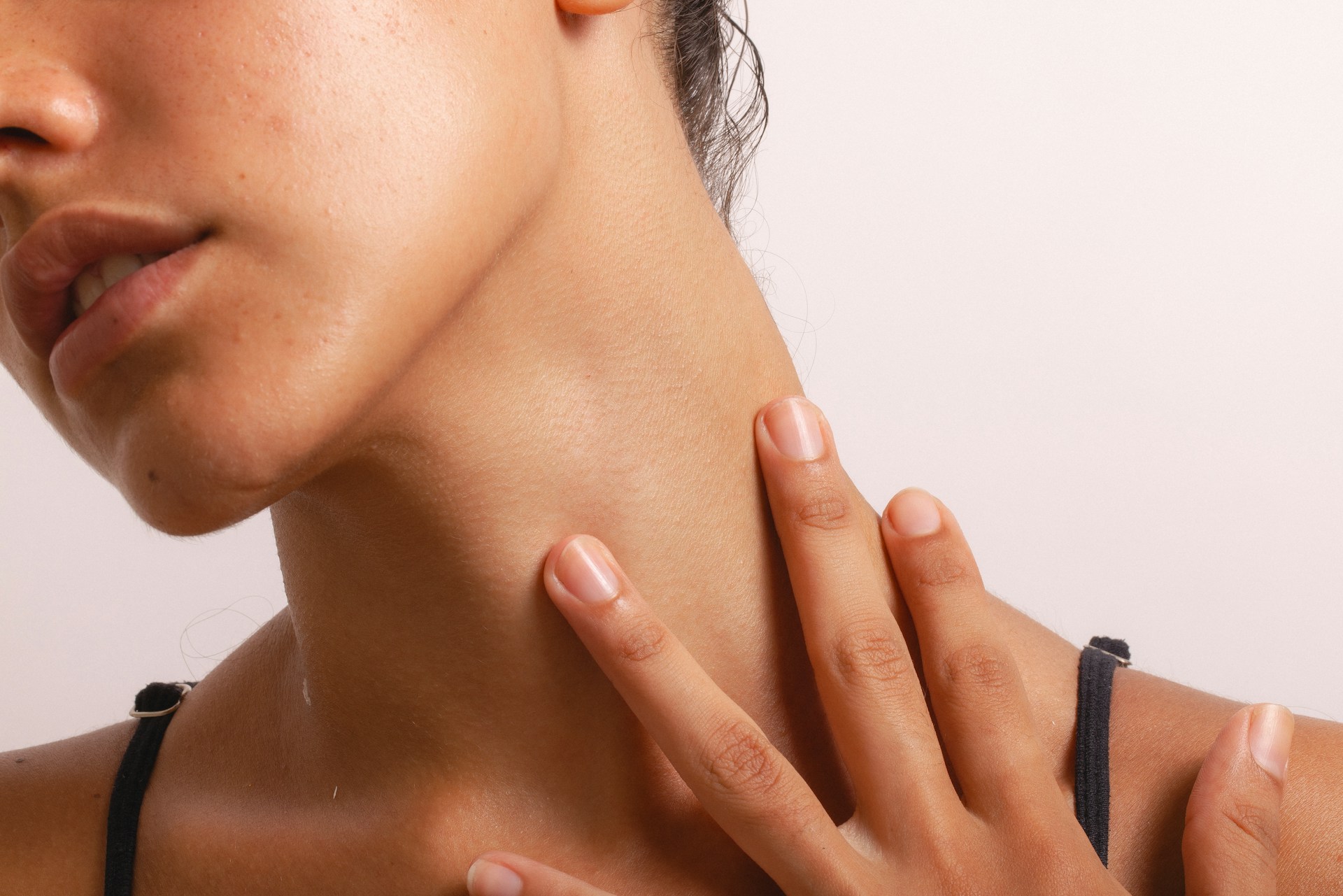 Acute Neck Pain